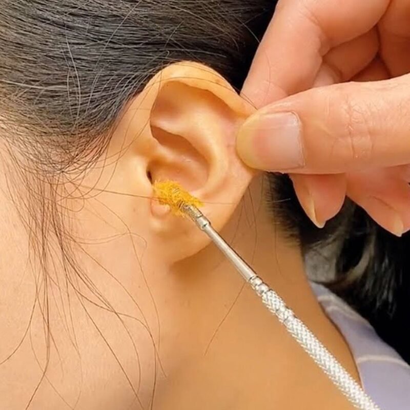Ear Wax Cleaner - Image 4